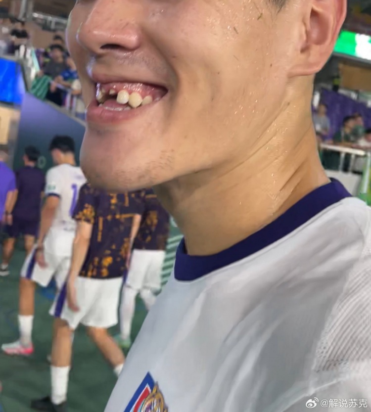 記者：王獻(xiàn)均門(mén)牙留在了黃龍?bào)w育中心，很多人一起找都沒(méi)找到